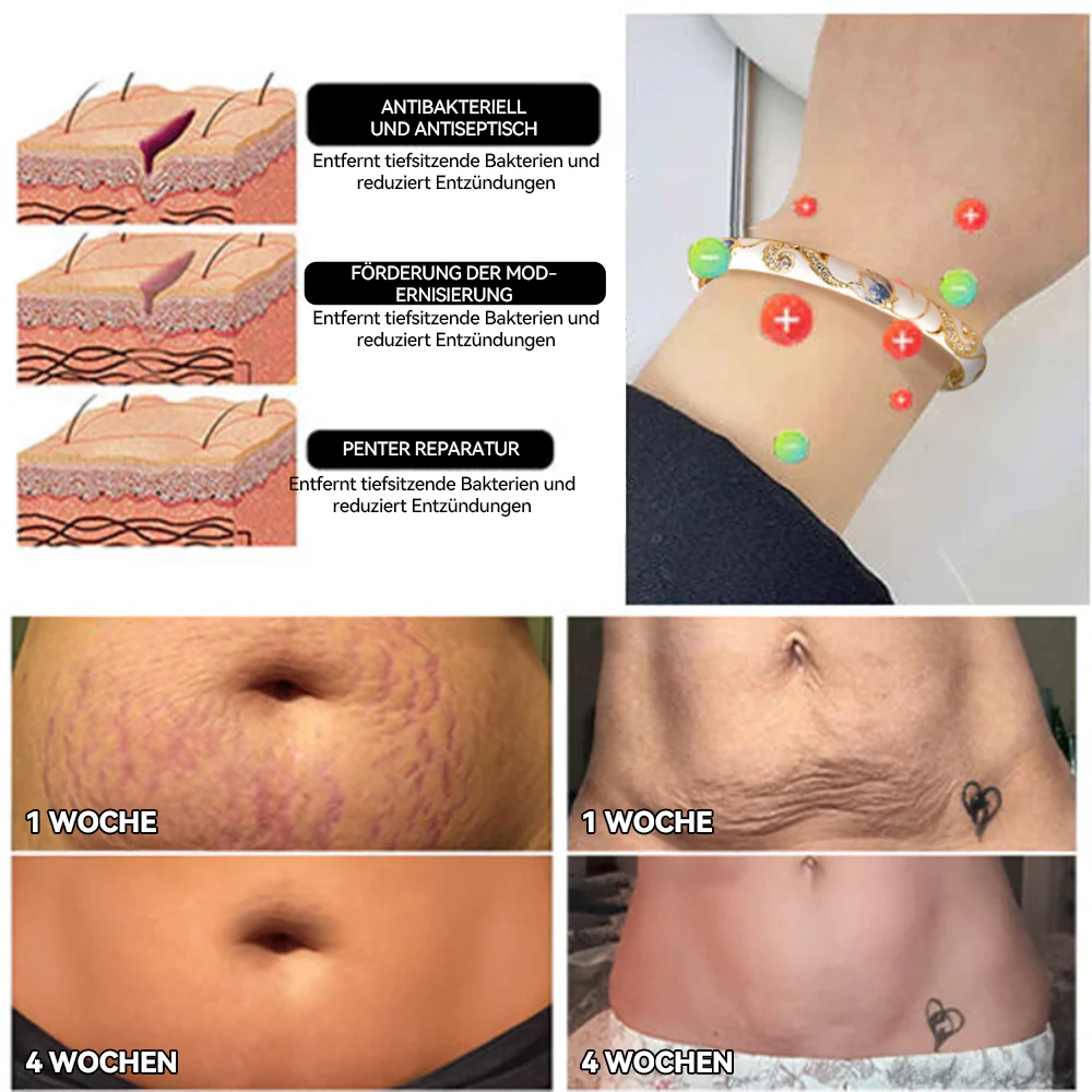 🎁🎁𝐂𝐙𝐓𝐈𝐂𝐋𝐄® 𝑪𝒍𝒐𝒊𝒔𝒐𝒏𝒏é 𝑬𝒎𝒂𝒊𝒍𝒍𝒆 👩‍⚕️ 𝑳𝒚𝒎𝒑𝒉𝒂𝒕𝒊𝒔𝒄𝒉𝒆 𝑴𝒂𝒈𝒏𝒆𝒕𝒕𝒉𝒆𝒓𝒂𝒑𝒊𝒆 𝑮𝒐𝒍𝒅𝒂𝒓𝒎𝒃𝒂𝒏𝒅 - Image 4