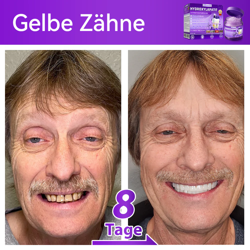 🛡️🥰Neujahrs‑Angebot: 80 % RABATT 🎉 Dormorna® Hydroxylapatit‑Zahnreparaturpulver 🦷 - Image 3