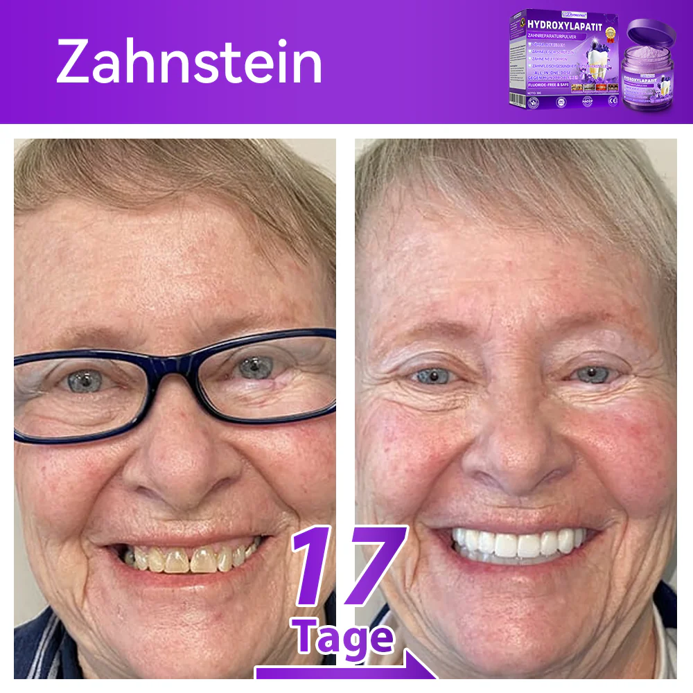 🛡️🥰Neujahrs‑Angebot: 80 % RABATT 🎉 Dormorna® Hydroxylapatit‑Zahnreparaturpulver 🦷 - Image 4