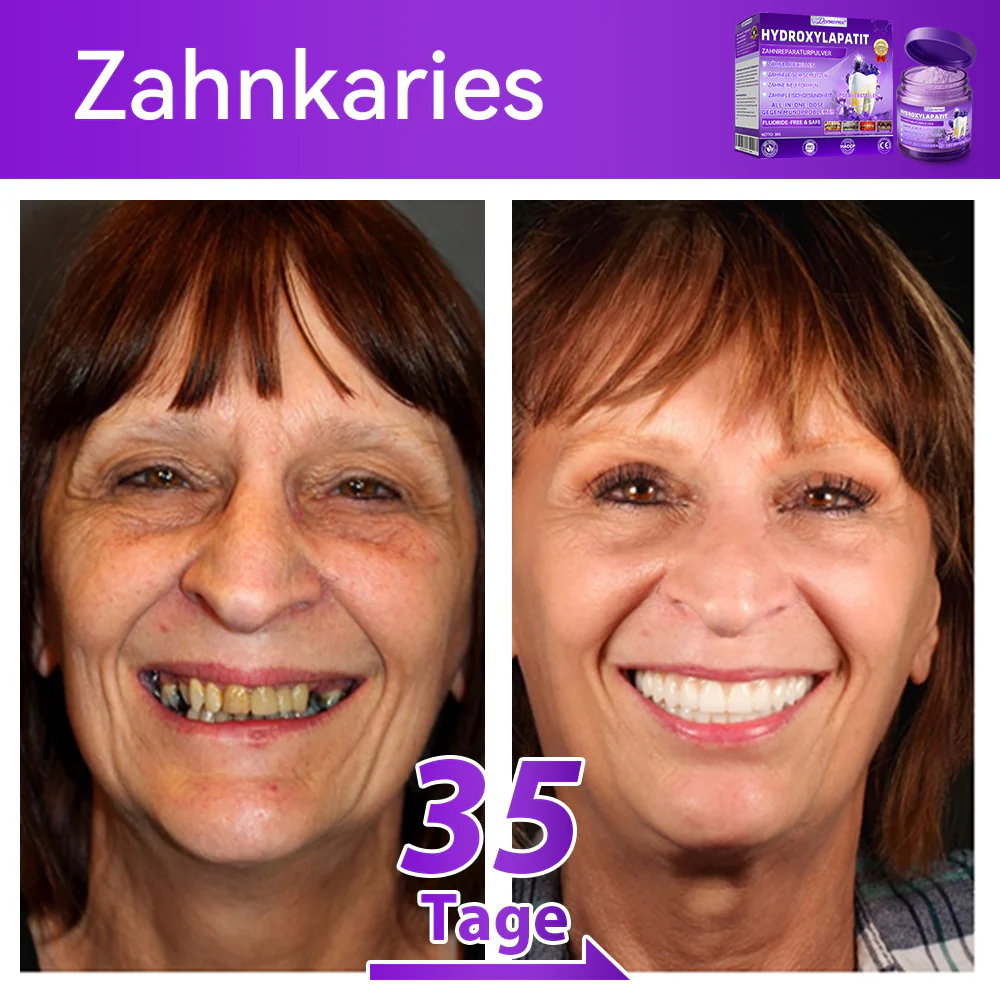 🛡️🥰Neujahrs‑Angebot: 80 % RABATT 🎉 Dormorna® Hydroxylapatit‑Zahnreparaturpulver 🦷 - Image 5
